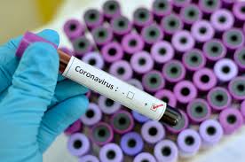Coronavírus: 419 pacientes já se recuperaram no Paraná
